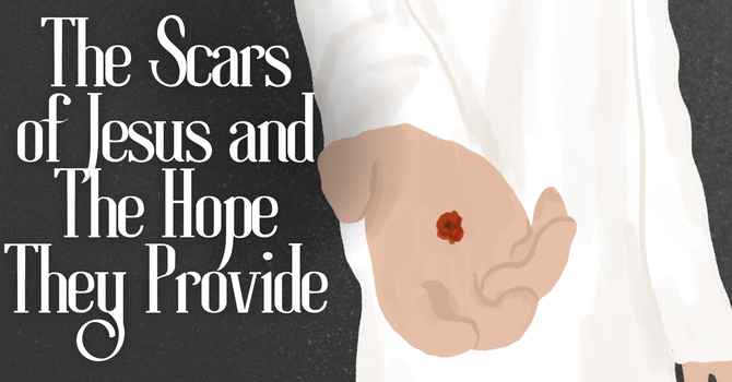 The Scars of Jesus and the Hope They Provide