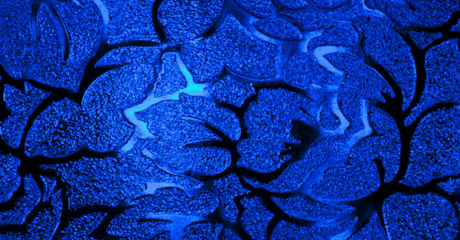 Blue Christmas 2021 image