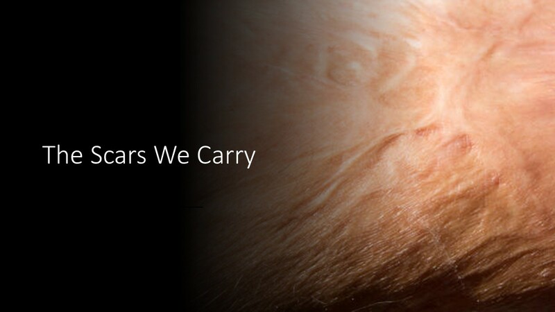 The Scars We Carry