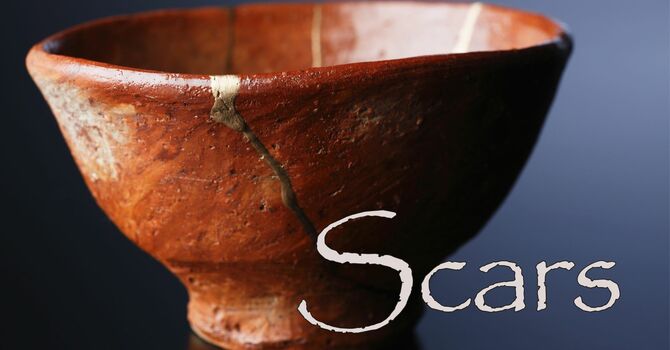 The Scars of Jesus