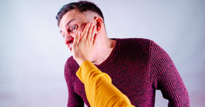 Turn the Other Cheek image